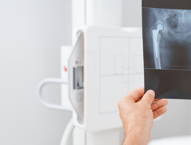 Ein Arzt untersucht ein Röntgenbild